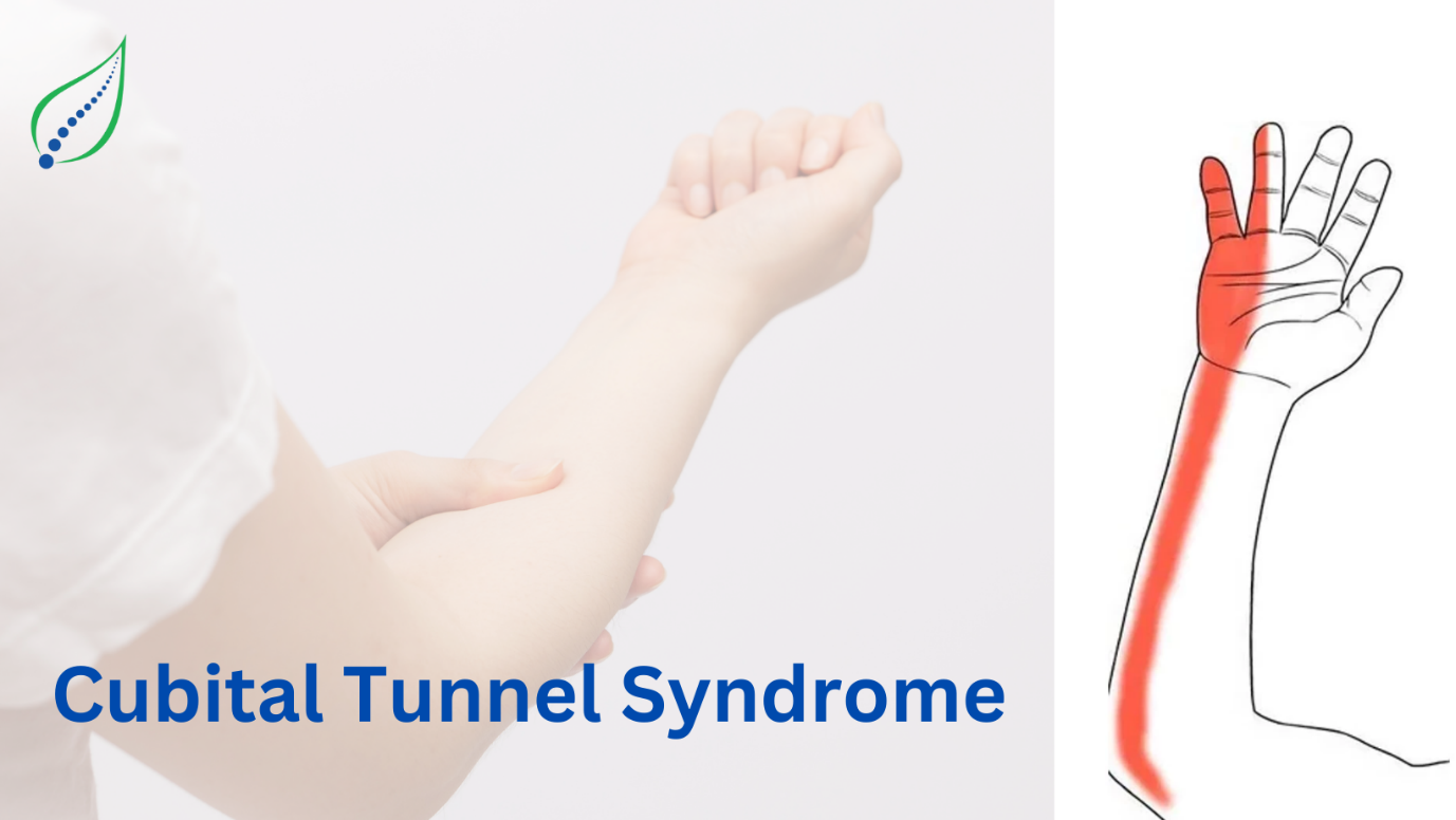 Cubital Tunnel Syndrome